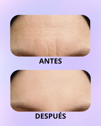 Parches Antiarrugas Frente